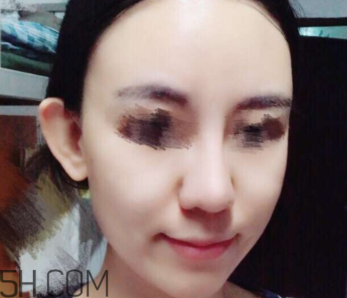 京潤珍珠玻尿酸面膜怎么樣？多少錢？