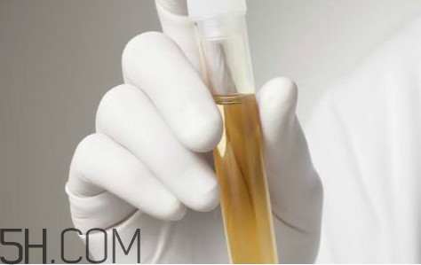 尿毒癥怎么預(yù)防？尿毒癥可以同房嗎