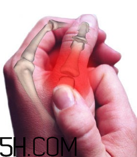 冬天關(guān)節(jié)痛怎么回事？關(guān)節(jié)痛怎么辦？