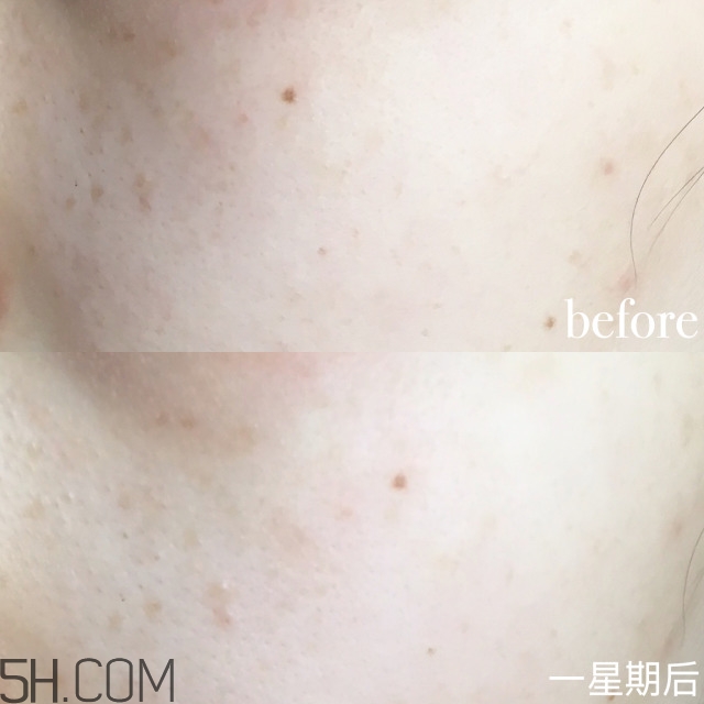 2018淡斑產(chǎn)品排行榜10強(qiáng)最新推薦 2018淡斑產(chǎn)品排行榜10強(qiáng)最新推薦
