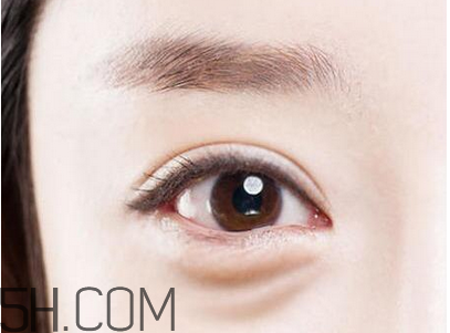 超聲法去眼袋效果好不好？超聲刀可以去除眼袋嗎？