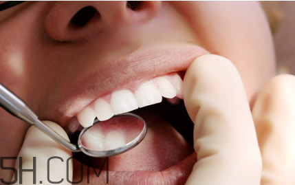 洗牙后牙縫變大是怎么回事？怎么保持牙齒潔白？