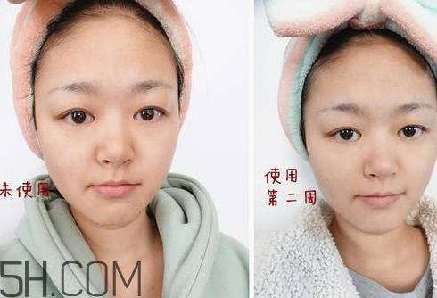 頂熙素顏霜有副作用嗎 頂熙素顏霜會反彈嗎 頂熙素顏霜有副作用嗎 頂熙素顏霜會反彈嗎