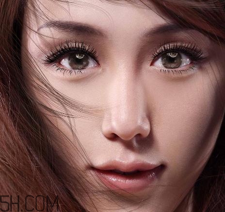 上瞼提肌手術(shù)有必要嗎？上瞼提肌后是永久的嗎？