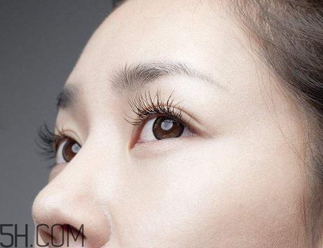 上瞼提肌手術(shù)有必要嗎？上瞼提肌后是永久的嗎？