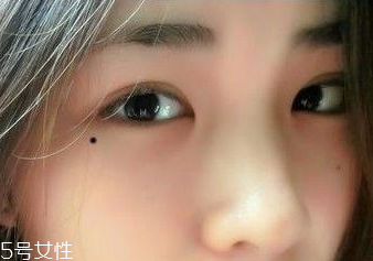 痣越多越長(zhǎng)壽嗎？身上最有福氣的吉痣