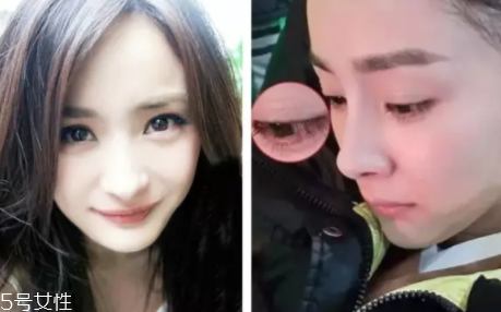 內(nèi)雙怎么進(jìn)化成雙眼皮？全是雙眼皮貼的功勞