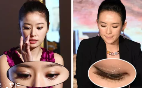 內(nèi)雙怎么進(jìn)化成雙眼皮？全是雙眼皮貼的功勞