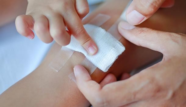 被螃蟹夾出血了怎么辦 如何正確處理傷口 被螃蟹夾出血了怎么辦 如何正確處理傷口