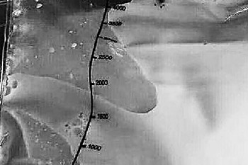 溫州姑娘吃了一年外賣得胰腺炎 胰腺炎有什么癥狀 溫州姑娘吃了一年外賣得胰腺炎 胰腺炎有什么癥狀