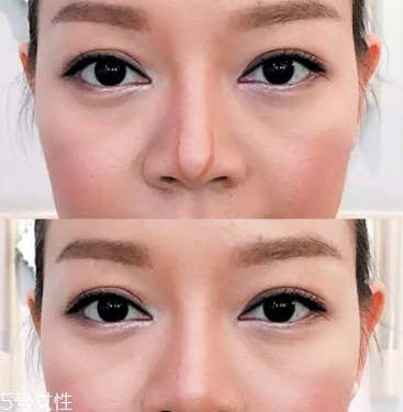 眉粉可以當鼻影用嗎？眉粉這樣畫鼻影