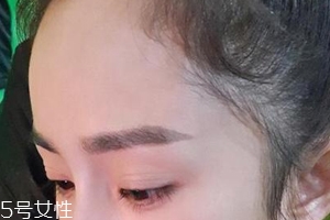 發(fā)際線高怎么治？拯救發(fā)際線攻略