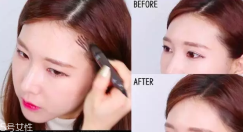 發(fā)際線高怎么治？拯救發(fā)際線攻略