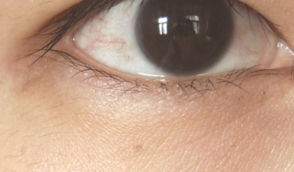 雅詩蘭黛適合敏感肌嗎？