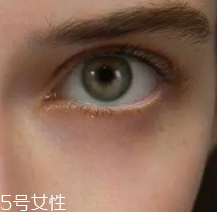 黑眼圈用什么眼霜好？多效護(hù)理型眼霜是首選