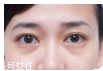 黑眼圈用什么眼霜好？多效護(hù)理型眼霜是首選