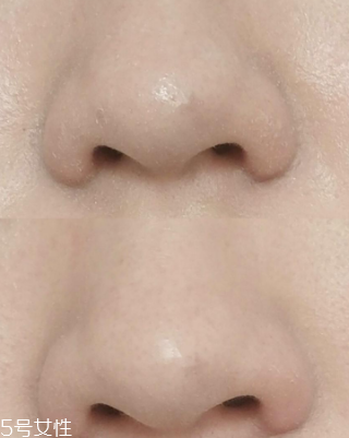 城野醫(yī)生收斂水可以每天用嗎？每天使用效果更佳