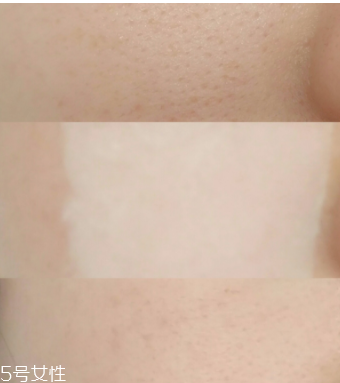 城野醫(yī)生收斂水可以每天用嗎？每天使用效果更佳