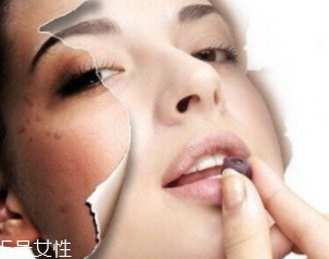 春季如何預防皮膚過敏？選擇敏感肌專用護膚品