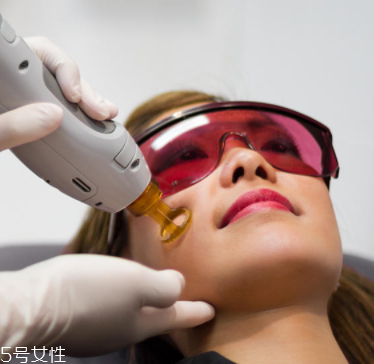 唇毛怎么去掉小竅門 4種常見去毛方法的優(yōu)缺點 唇毛怎么去掉小竅門 4種常見去毛方法的優(yōu)缺點