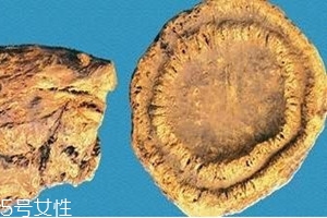 大黃是涼性的嗎 性寒味苦 大黃是涼性的嗎 性寒味苦