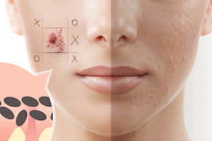 去角質(zhì)啫喱多久用一次？