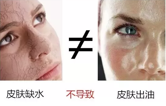 臉上外油內(nèi)干怎么辦 外油內(nèi)干的皮膚這樣護理 臉上外油內(nèi)干怎么辦 外油內(nèi)干的皮膚這樣護理