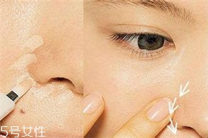 鼻子兩邊為什么會(huì)有紅血絲 紅血絲肌膚的日常護(hù)理 鼻子兩邊為什么會(huì)有紅血絲 紅血絲肌膚的日常護(hù)理