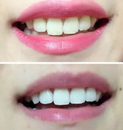 mistine美牙筆怎么用？mistine美牙筆評測