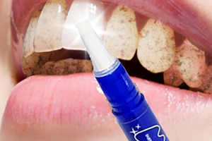 mistine美牙筆怎么用？mistine美牙筆評測