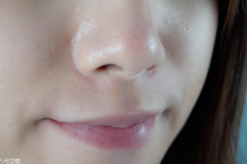 泊舒清痘霜有用嗎 泊舒清痘能力實(shí)測(cè) 泊舒清痘霜有用嗎 泊舒清痘能力實(shí)測(cè)