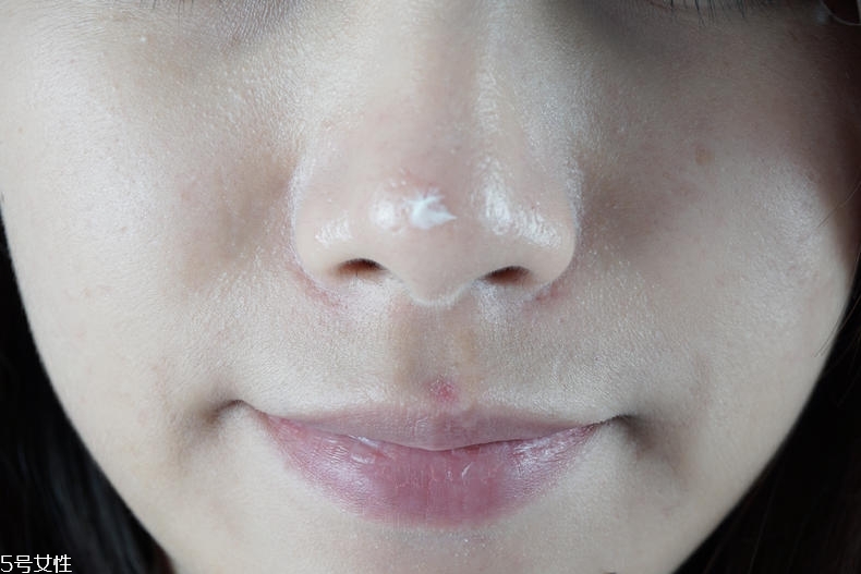 泊舒清痘霜有用嗎 泊舒清痘能力實(shí)測(cè) 泊舒清痘霜有用嗎 泊舒清痘能力實(shí)測(cè)