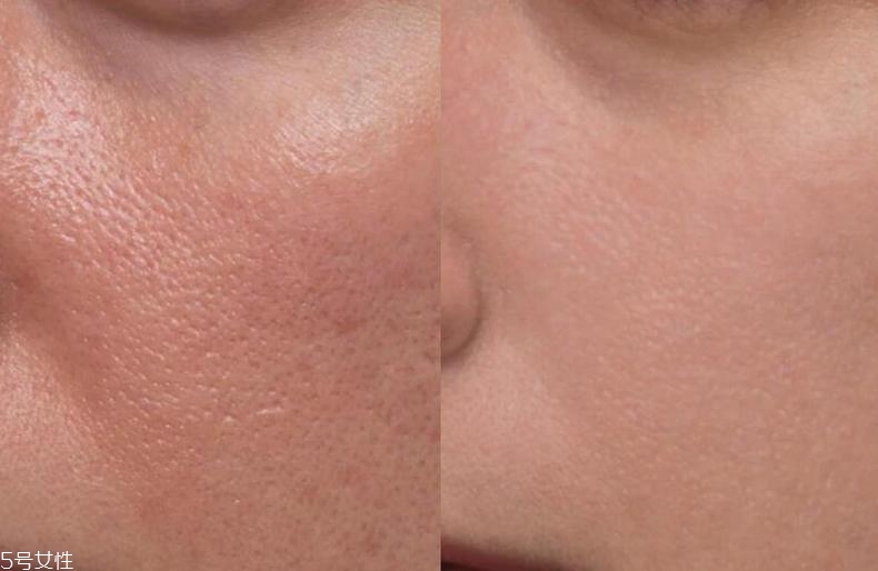 itcosmetics隱形毛孔定妝粉好用嗎 清爽控油適合夏季 itcosmetics隱形毛孔定妝粉好用嗎 清爽控油適合夏季