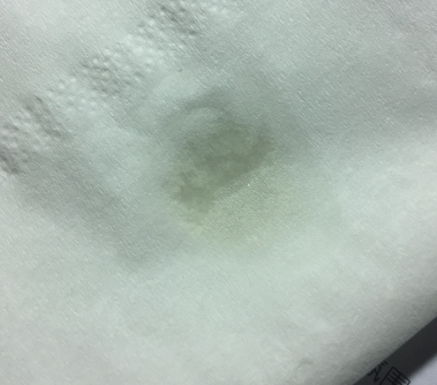 天竺葵精油可以去黑頭嗎？天竺葵精油怎么去黑頭