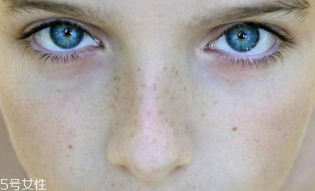 什么牌子的去黑頭的產(chǎn)品比較好 去黑頭面膜推薦 什么牌子的去黑頭的產(chǎn)品比較好 去黑頭面膜推薦