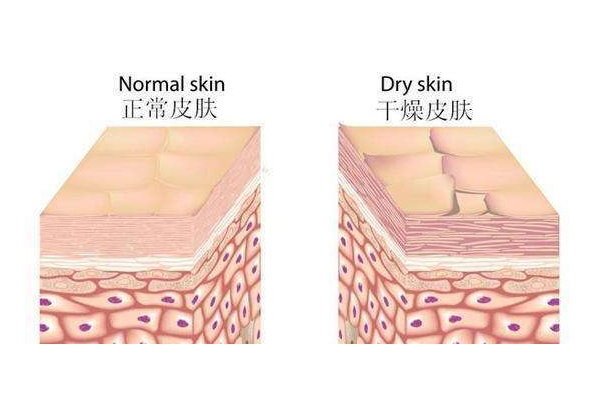 干皮怎么補水 干皮科學(xué)補水三步走 干皮怎么補水 干皮科學(xué)補水三步走