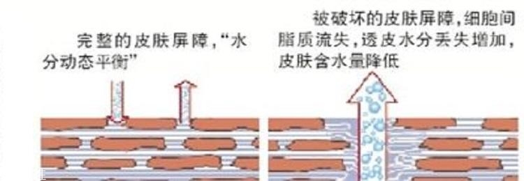 干皮怎么補水 干皮科學(xué)補水三步走 干皮怎么補水 干皮科學(xué)補水三步走