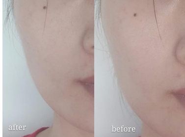 ulike美容儀怎么用？ulike美容儀充電