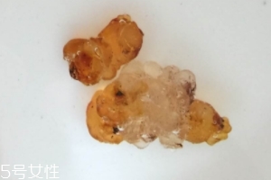 桃膠可以用開水泡嗎？用開水泡桃膠好嗎？