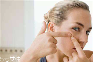 痘痘擠破了出血怎么辦 痘痘長膿后的注意事項 痘痘擠破了出血怎么辦 痘痘長膿后的注意事項