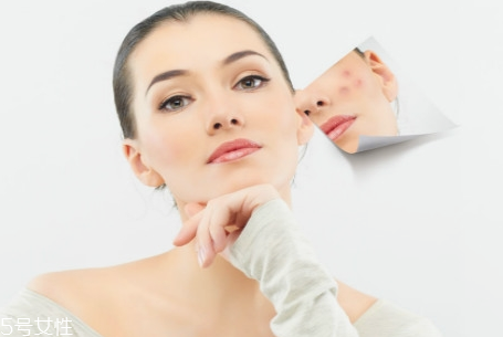 臉上為什么長(zhǎng)痘 長(zhǎng)痘痘的原因介紹 臉上為什么長(zhǎng)痘 長(zhǎng)痘痘的原因介紹