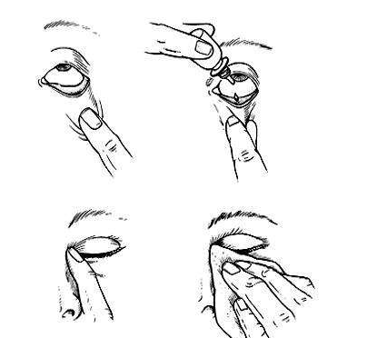 眼藥水兒童可以用嗎？眼藥水適合兒童用嗎？