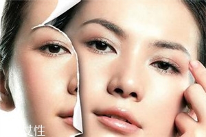 皺紋該如何防止 祛皺護(hù)膚品都有哪些 皺紋該如何防止 祛皺護(hù)膚品都有哪些