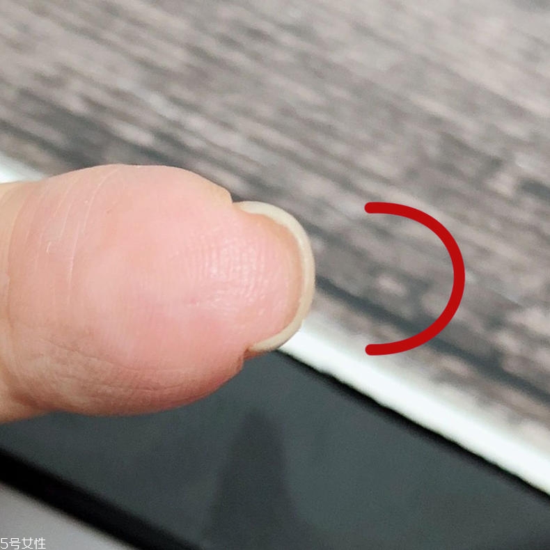 扇形甲怎么修復 扇形甲修復方法