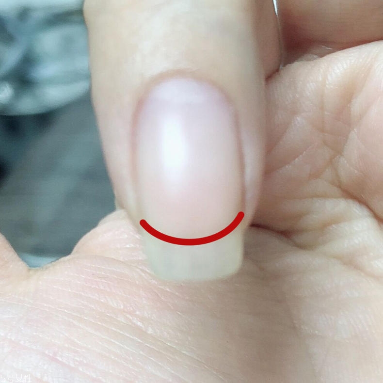 扇形甲怎么修復 扇形甲修復方法