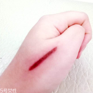 創(chuàng)可貼和肉連著怎么辦？創(chuàng)可貼連著肉怎么處理？