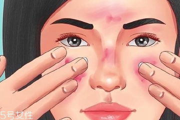 凡士林能治痘痘嗎 凡士林對痘痘有效嗎 凡士林能治痘痘嗎 凡士林對痘痘有效嗎