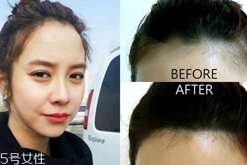 用眼影怎么修飾發(fā)際線 用眼影修飾發(fā)際線的3個步驟 用眼影怎么修飾發(fā)際線 用眼影修飾發(fā)際線的3個步驟