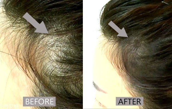 用眼影怎么修飾發(fā)際線 用眼影修飾發(fā)際線的3個步驟 用眼影怎么修飾發(fā)際線 用眼影修飾發(fā)際線的3個步驟