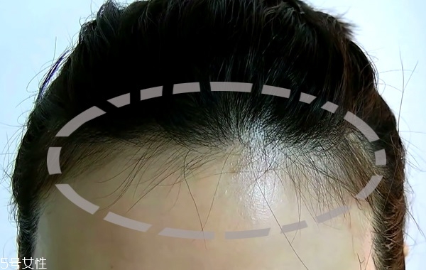 用眼影怎么修飾發(fā)際線 用眼影修飾發(fā)際線的3個步驟 用眼影怎么修飾發(fā)際線 用眼影修飾發(fā)際線的3個步驟